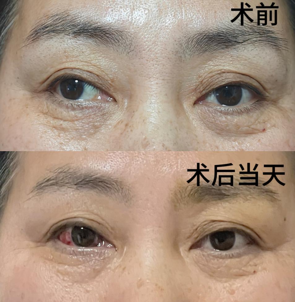 3e7b89b4934cc9edd52cbce24c7fdff3