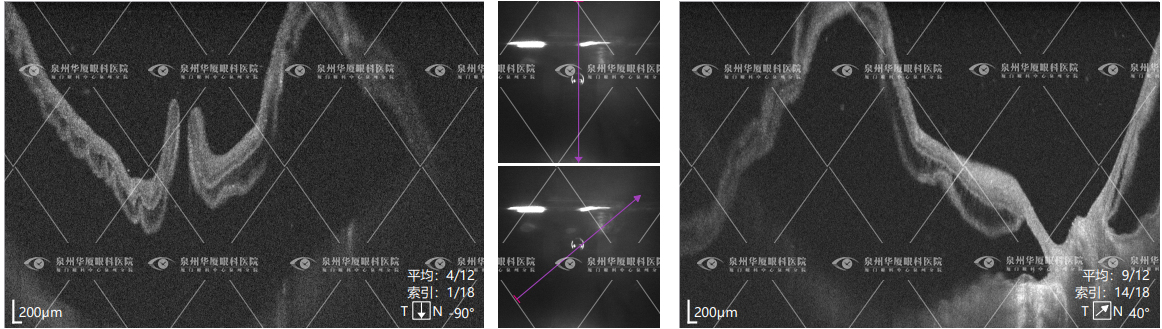 1916f5cb88f62f07acbabbd5d06b1bea