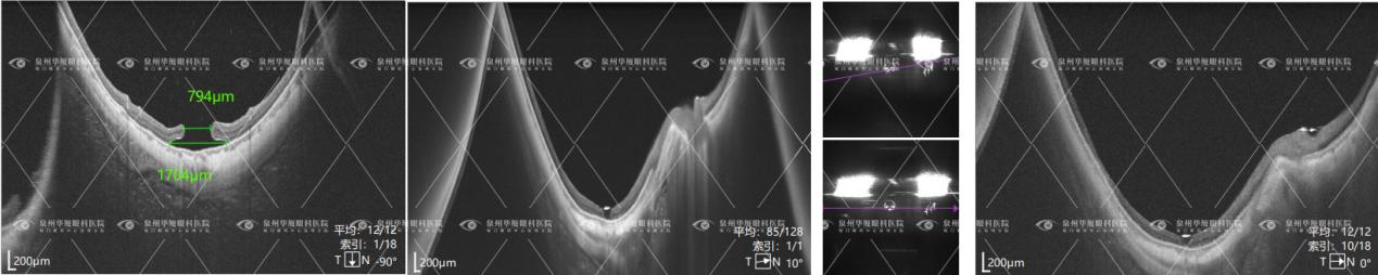 a2bb578439dbb0eacc59a4a4fd06d047