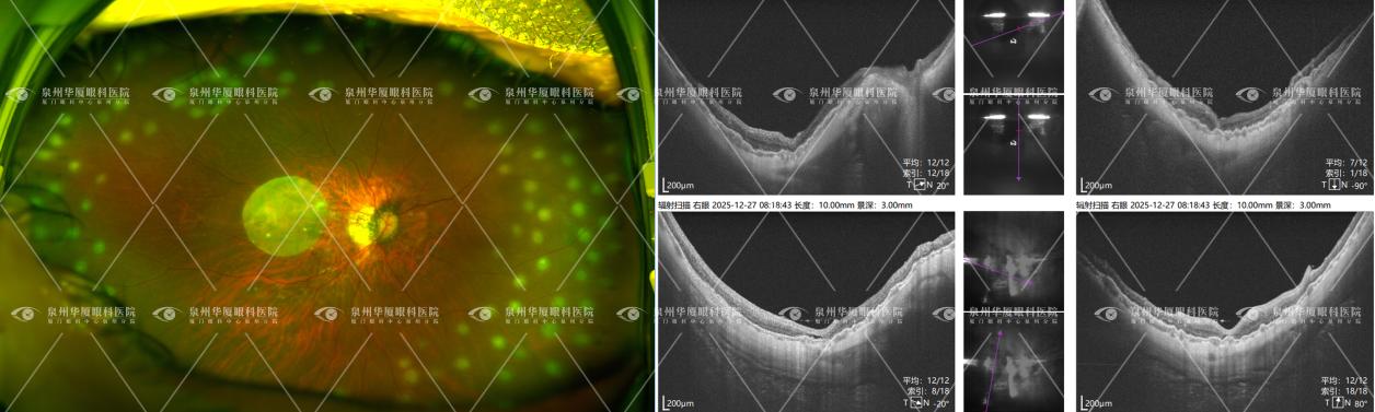 5a9f7f63279c94e265224f3100ec3dd9